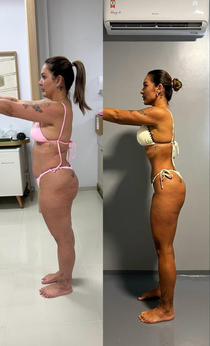 Antes e depois da transformação física de Areta